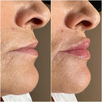 Adrianna Kobus - Kosmetolog medyczny, Trycholog, Linergistka